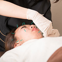 Small face, beauty acupuncture